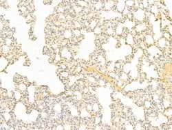 Invitrogen Phospho-AMPK alpha-1,2 (Thr172) Polyclonal Antibody 100 &mu;L;
