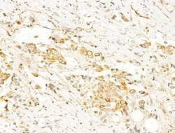 Invitrogen Phospho-AMPK alpha-1,2 (Thr172) Polyclonal Antibody 100 &mu;L;