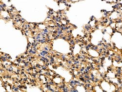Invitrogen Phospho-Caspase 8 (Tyr380) Polyclonal Antibody 100 &mu;L; Unconjugated:Antibodies,