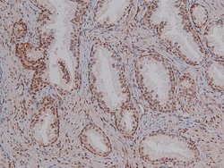 Phospho-CDK4 (Thr172) Polyclonal Antibody, Invitrogen 100 &mu;L; Unconjugated:Antibodies,