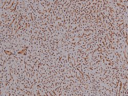 Phospho-CDK4 (Thr172) Polyclonal Antibody, Invitrogen 100 &mu;L; Unconjugated:Antibodies,