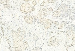 Phospho-CDK4 (Thr172) Polyclonal Antibody, Invitrogen 100 &mu;L; Unconjugated:Antibodies,