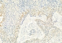Phospho-CDK4 (Thr172) Polyclonal Antibody, Invitrogen 100 &mu;L; Unconjugated:Antibodies,