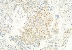 Phospho-CDK4 (Thr172) Polyclonal Antibody, Invitrogen 100 &mu;L; Unconjugated:Antibodies,