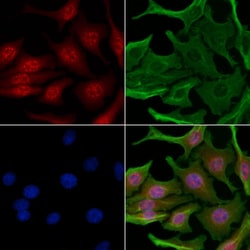 Invitrogen Phospho-Chk2 (Ser33, Ser35) Polyclonal Antibody 100 &mu;L; Unconjugated:Antibodies,