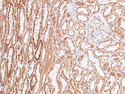 Invitrogen Phospho-Chk2 (Ser33, Ser35) Polyclonal Antibody 100 &mu;L; Unconjugated:Antibodies,