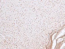 Invitrogen Phospho-Chk2 (Ser33, Ser35) Polyclonal Antibody 100 &mu;L; Unconjugated:Antibodies,