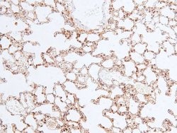Invitrogen Phospho-Chk2 (Ser33, Ser35) Polyclonal Antibody 100 &mu;L; Unconjugated:Antibodies,