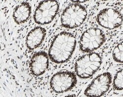 Invitrogen Phospho-C-Jun (Ser73) Polyclonal Antibody 100 &mu;L; Unconjugated:Antibodies,
