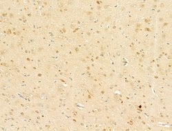 Invitrogen Phospho-C-Jun (Ser73) Polyclonal Antibody 100 &mu;L; Unconjugated:Antibodies,