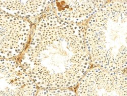 Invitrogen Phospho-C-Jun (Ser73) Polyclonal Antibody 100 &mu;L; Unconjugated:Antibodies,