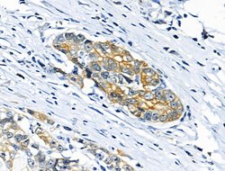 Invitrogen Phospho-Cytokeratin 18 (Ser53) Polyclonal Antibody 100 &mu;L;