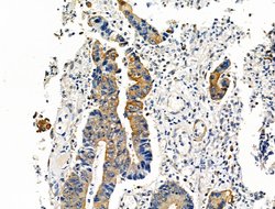 Invitrogen Phospho-Cytokeratin 18 (Ser53) Polyclonal Antibody 100 &mu;L;
