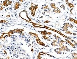 Invitrogen Phospho-Cytokeratin 18 (Ser53) Polyclonal Antibody 100 &mu;L;