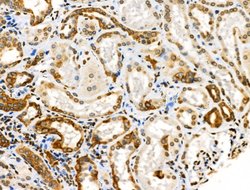 Invitrogen Phospho-Cytokeratin 18 (Ser53) Polyclonal Antibody 100 &mu;L;