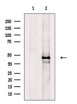 Invitrogen Phospho-Cytokeratin 18 (Ser53) Polyclonal Antibody 100 &mu;L;