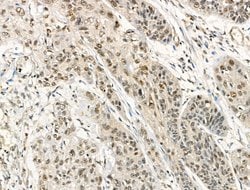 Invitrogen Phospho-DNMT1 (Ser714) Polyclonal Antibody 100 &mu;L; Unconjugated:Antibodies,