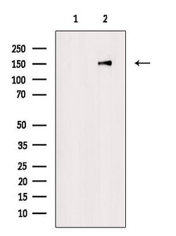 Invitrogen Phospho-DNMT1 (Tyr399) Polyclonal Antibody 100 &mu;L | Buy Online | Invitrogen&trade; | Fisher Scientific