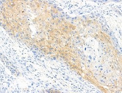 Invitrogen Phospho-EIF4B (Ser504) Polyclonal Antibody 100 &mu;L; Unconjugated:Antibodies,