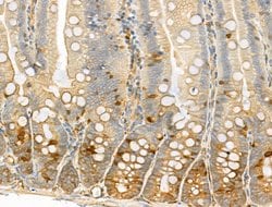 Invitrogen Phospho-EIF4B (Ser504) Polyclonal Antibody 100 &mu;L; Unconjugated:Antibodies,