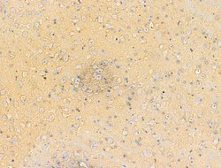 Invitrogen Phospho-EPRS (Ser886) Polyclonal Antibody 100 &mu;L; Unconjugated:Antibodies,