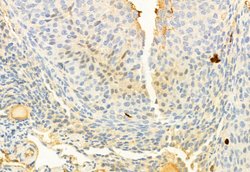Invitrogen Phospho-ERK5 (Thr219, Tyr221) Polyclonal Antibody 100 &mu;L;