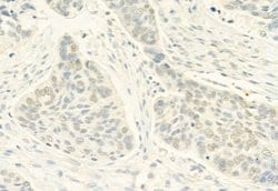 Invitrogen Phospho-ERK5 (Thr219, Tyr221) Polyclonal Antibody 100 &mu;L;