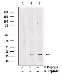 Invitrogen Phospho-FUNDC1 (Ser17) Polyclonal Antibody 100 &mu;L | Buy Online | Invitrogen&trade; | Fisher Scientific