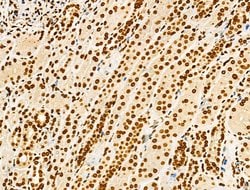 Invitrogen Phospho-GSK3B (Thr390) Polyclonal Antibody 100 &mu;L; Unconjugated:Antibodies,