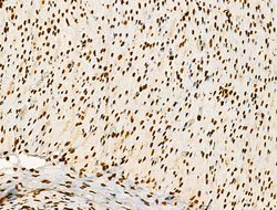 Invitrogen Phospho-GSK3B (Thr390) Polyclonal Antibody 100 &mu;L; Unconjugated:Antibodies,