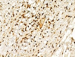 Invitrogen Phospho-GSK3B (Thr390) Polyclonal Antibody 100 &mu;L; Unconjugated:Antibodies,