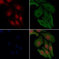 Invitrogen Phospho-HSF1 (Ser303) Polyclonal Antibody 100 &mu;L; Unconjugated:Antibodies,