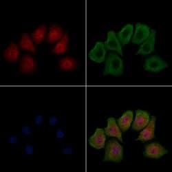 Invitrogen Phospho-HSF1 (Ser303) Polyclonal Antibody 100 &mu;L; Unconjugated:Antibodies,