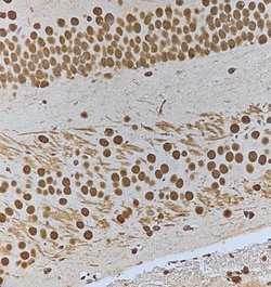 Invitrogen Phospho-HSF1 (Ser303) Polyclonal Antibody 100 &mu;L; Unconjugated:Antibodies,