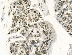 Invitrogen Phospho-HSP27 (Ser78) Polyclonal Antibody 100 &mu;L; Unconjugated:Antibodies,