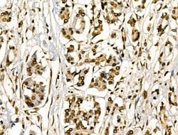 Invitrogen Phospho-HSP27 (Ser78) Polyclonal Antibody 100 &mu;L; Unconjugated:Antibodies,