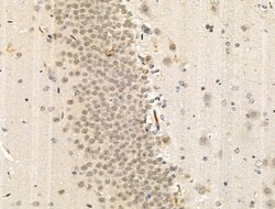 Invitrogen Phospho-HSP90 (Tyr627) Polyclonal Antibody 100 &mu;L; Unconjugated:Antibodies,