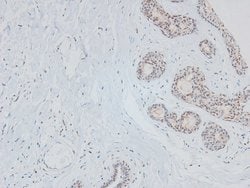 Invitrogen Phospho-Huntingtin (Ser419) Polyclonal Antibody 100 &mu;L | Buy Online | Invitrogen&trade; | Fisher Scientific