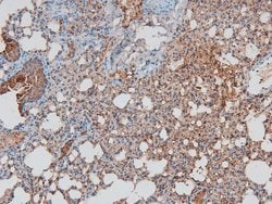 Invitrogen Phospho-Huntingtin (Ser419) Polyclonal Antibody 100 &mu;L | Buy Online | Invitrogen&trade; | Fisher Scientific