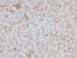 Invitrogen Phospho-Huntingtin (Ser419) Polyclonal Antibody 100 &mu;L | Buy Online | Invitrogen&trade; | Fisher Scientific