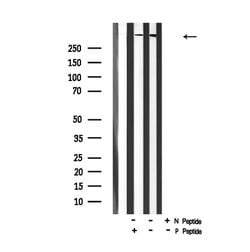 Invitrogen Phospho-Huntingtin (Ser419) Polyclonal Antibody 100 &mu;L | Buy Online | Invitrogen&trade; | Fisher Scientific
