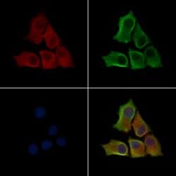 Invitrogen Phospho-ILK (Thr173) Polyclonal Antibody 100 &mu;L; Unconjugated:Antibodies,