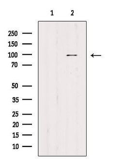 Invitrogen Phospho-Aconitase 1 (Ser711) Polyclonal Antibody 100 &mu;L | Buy Online | Invitrogen&trade; | Fisher Scientific