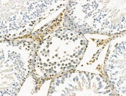 Invitrogen Phospho-JAK2 (Tyr1008) Polyclonal Antibody 100 &mu;L; Unconjugated:Antibodies,