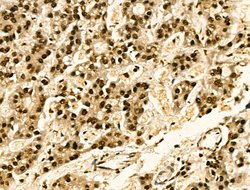 Invitrogen Phospho-JAK2 (Tyr1008) Polyclonal Antibody 100 &mu;L; Unconjugated:Antibodies,