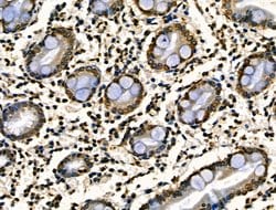 Invitrogen Phospho-JAK2 (Tyr1008) Polyclonal Antibody 100 &mu;L; Unconjugated:Antibodies,