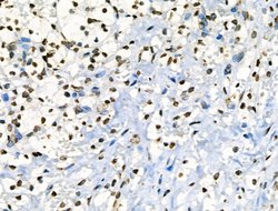 Invitrogen Phospho-JAK2 (Tyr1008) Polyclonal Antibody 100 &mu;L; Unconjugated:Antibodies,