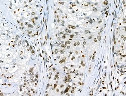Invitrogen Phospho-JAK2 (Tyr1008) Polyclonal Antibody 100 &mu;L; Unconjugated:Antibodies,