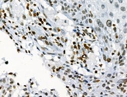 Invitrogen Phospho-JAK2 (Tyr1008) Polyclonal Antibody 100 &mu;L; Unconjugated:Antibodies,