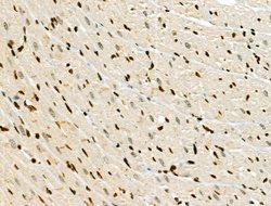 Invitrogen Phospho-JAK2 (Tyr1008) Polyclonal Antibody 100 &mu;L; Unconjugated:Antibodies,